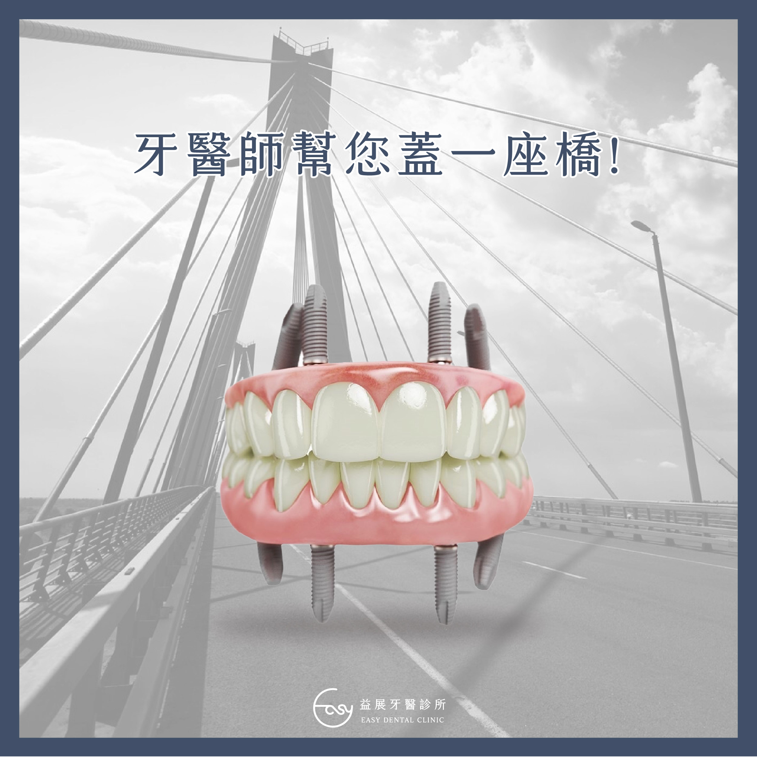牙醫師幫您蓋一座橋！