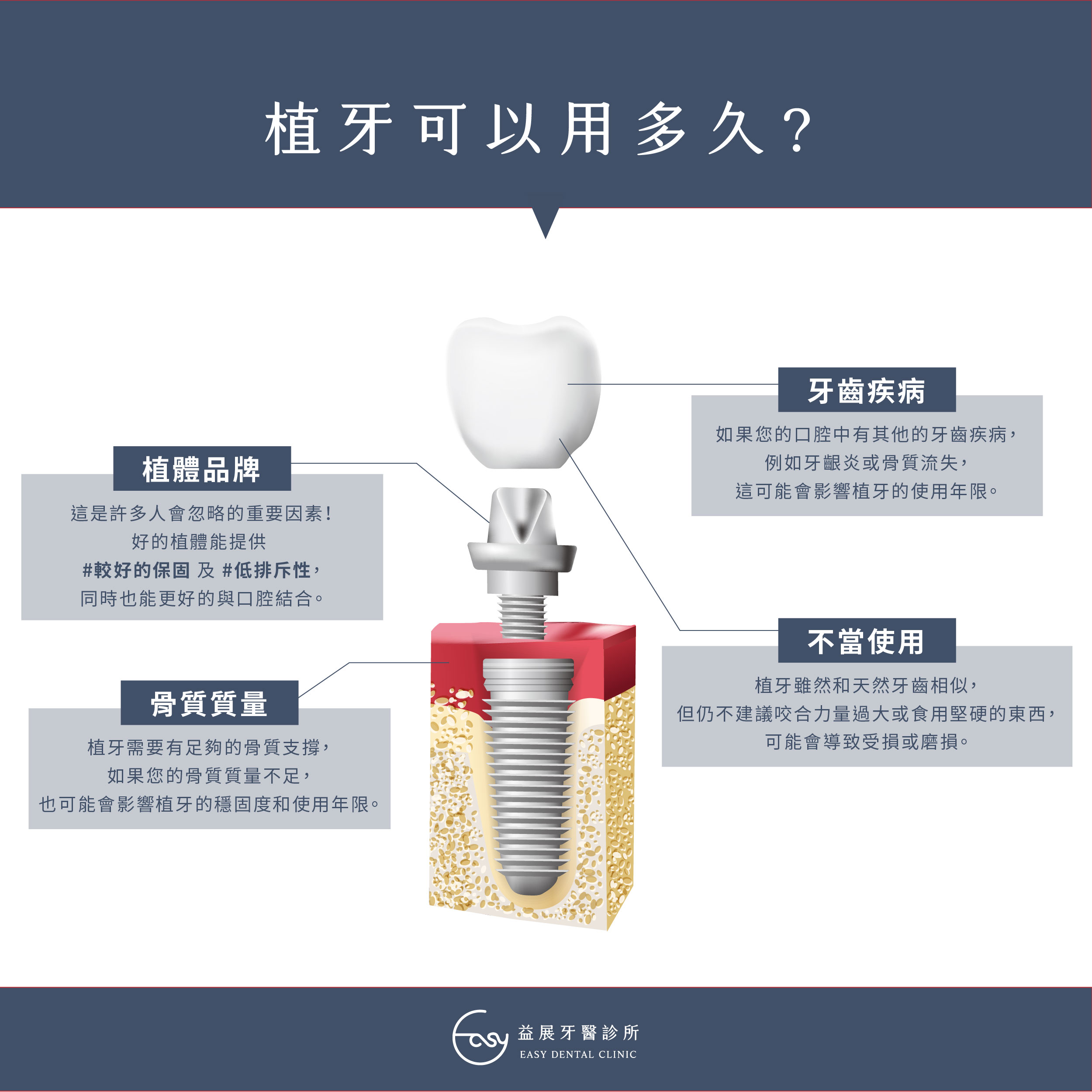 你知道植牙可以用多久嗎?