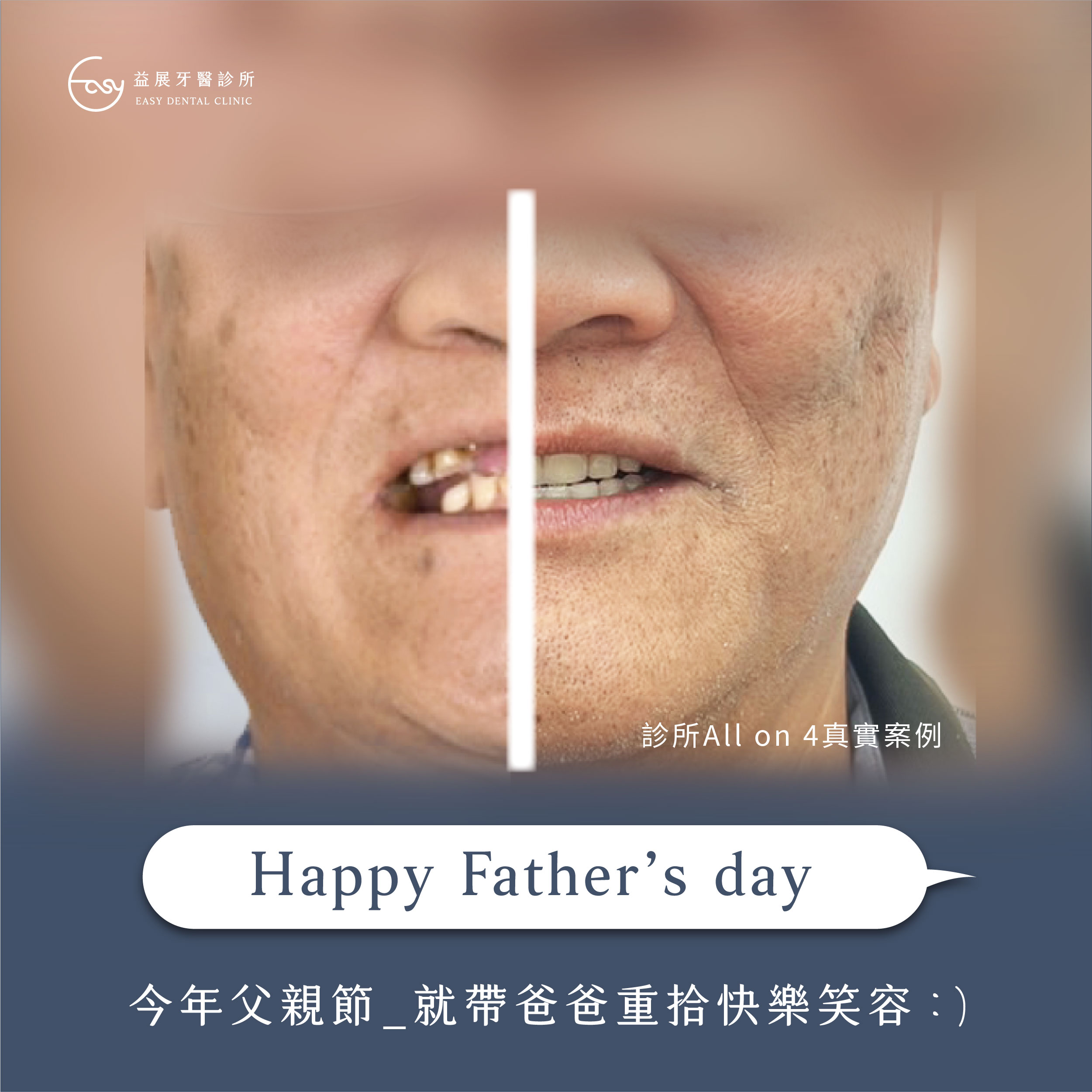 一起帶家人來免費全口重建評估