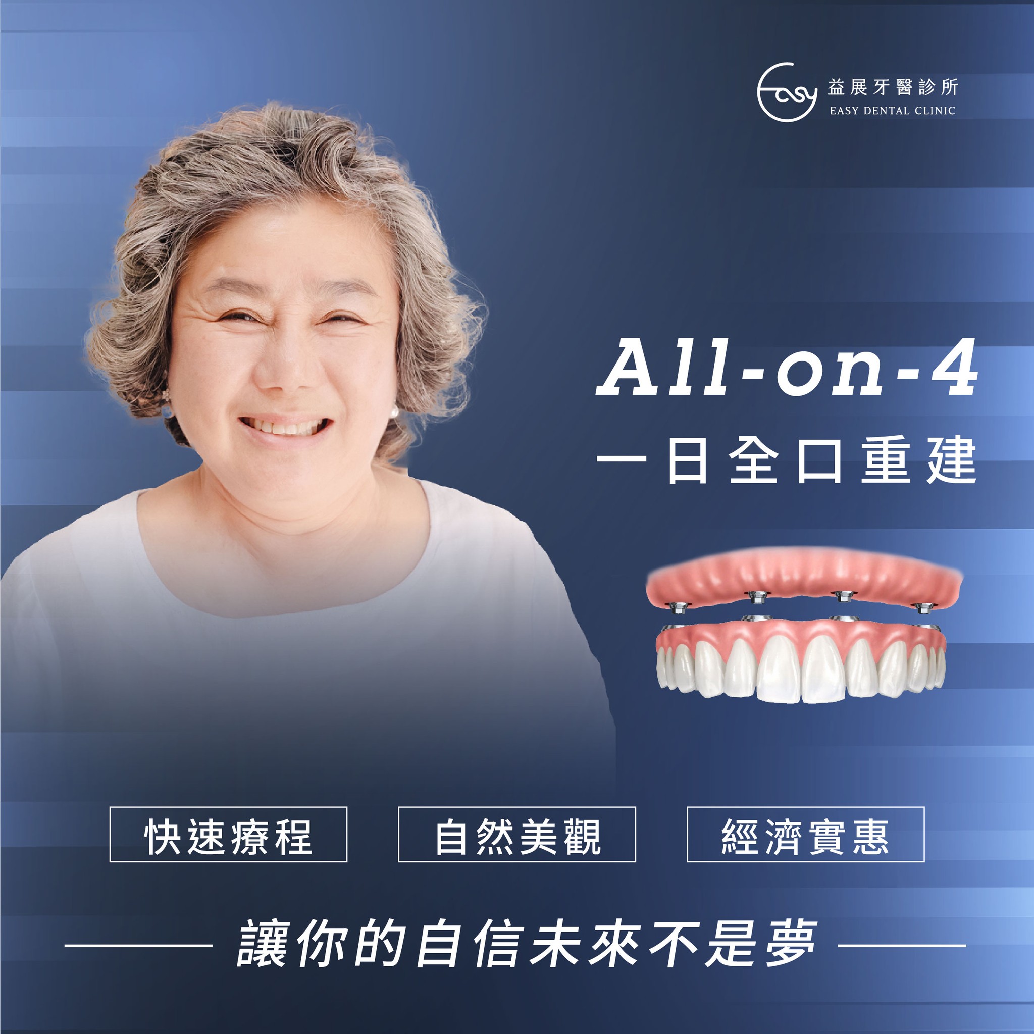 All-on-4一日全口重建 讓你的自信未來不是夢