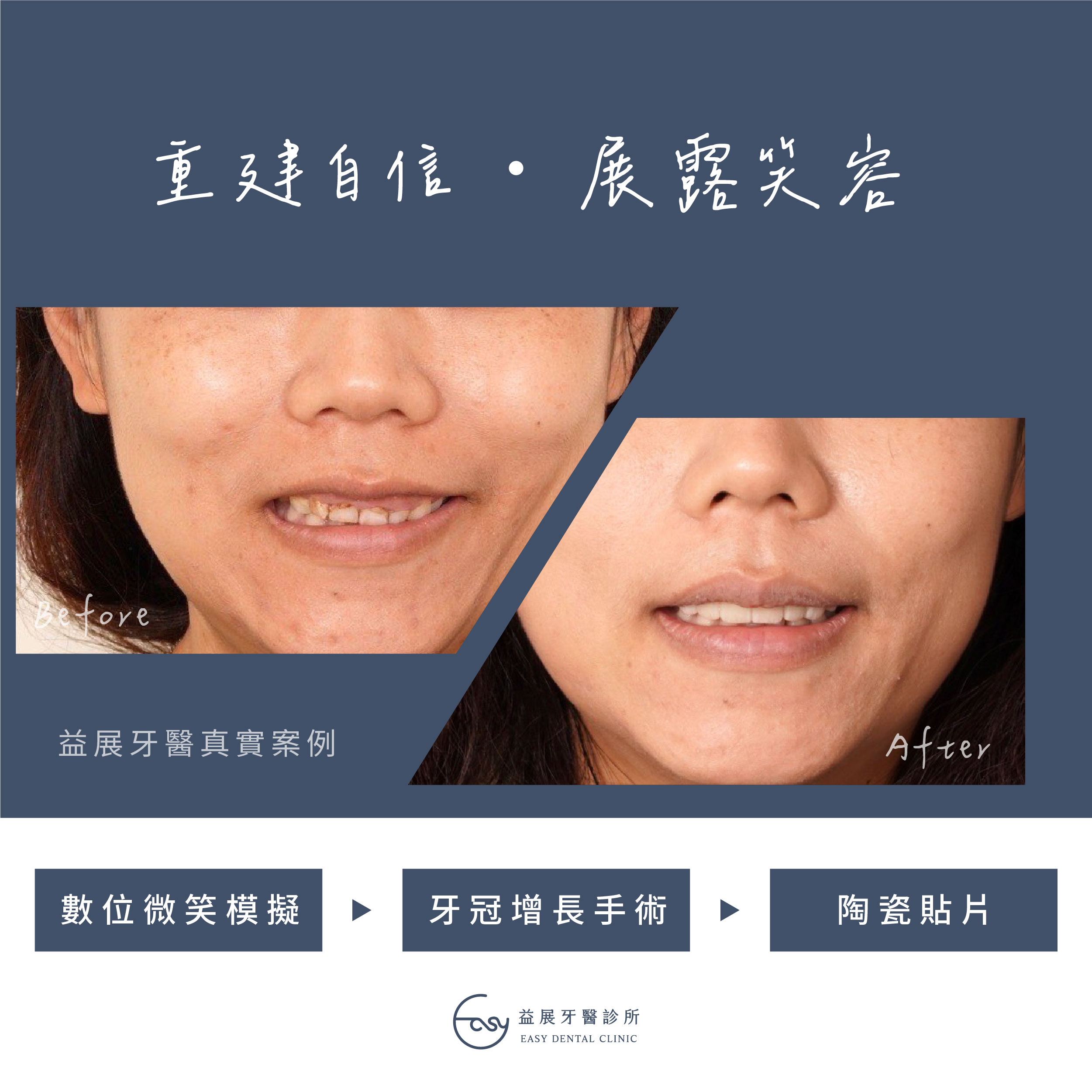 高豪醫師 美白案例分享