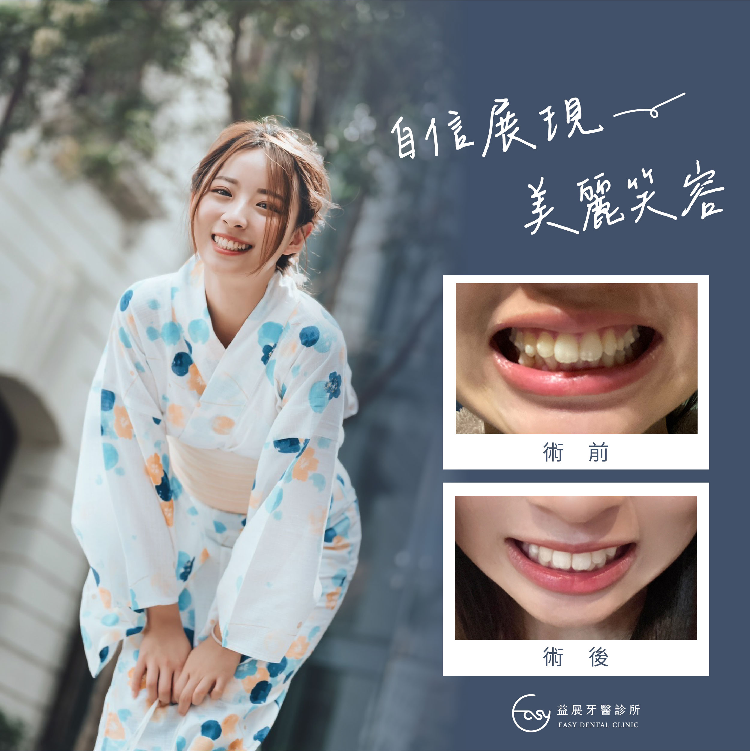 隱適美隱形矯正 讓您自信展現美麗笑容