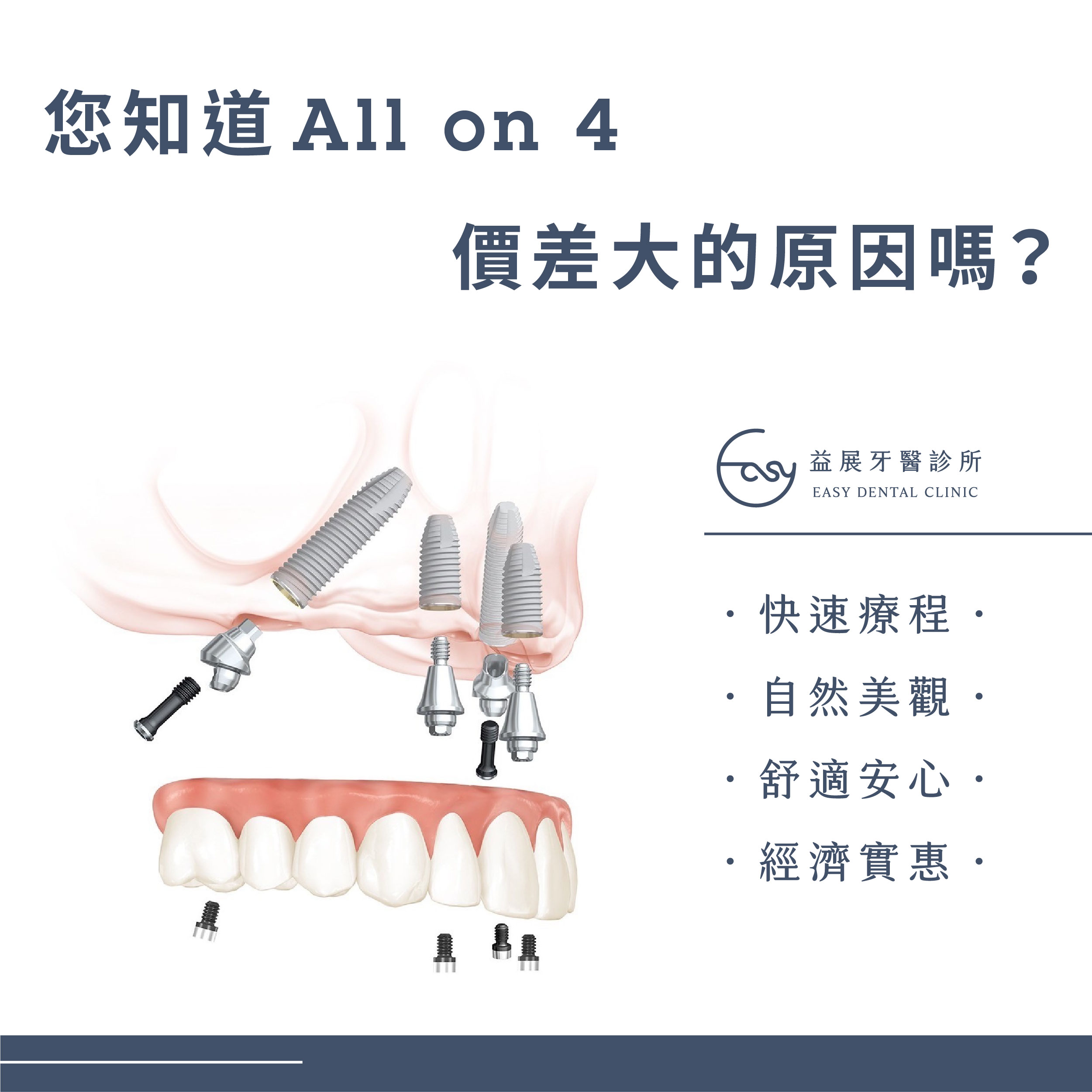 為什麼All-on-4全口重建價差這麼大?