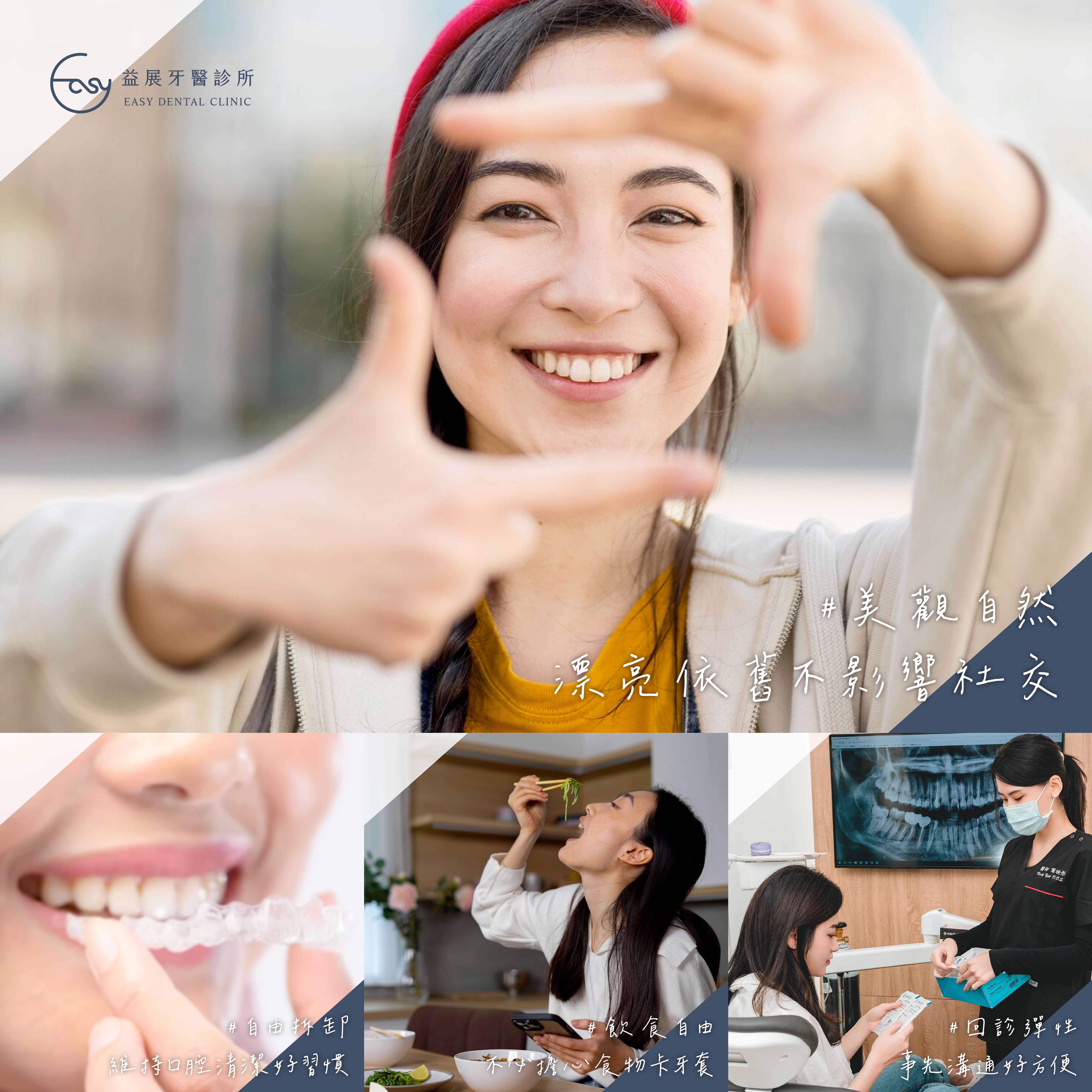 戴上隱適美,漂亮看得見!