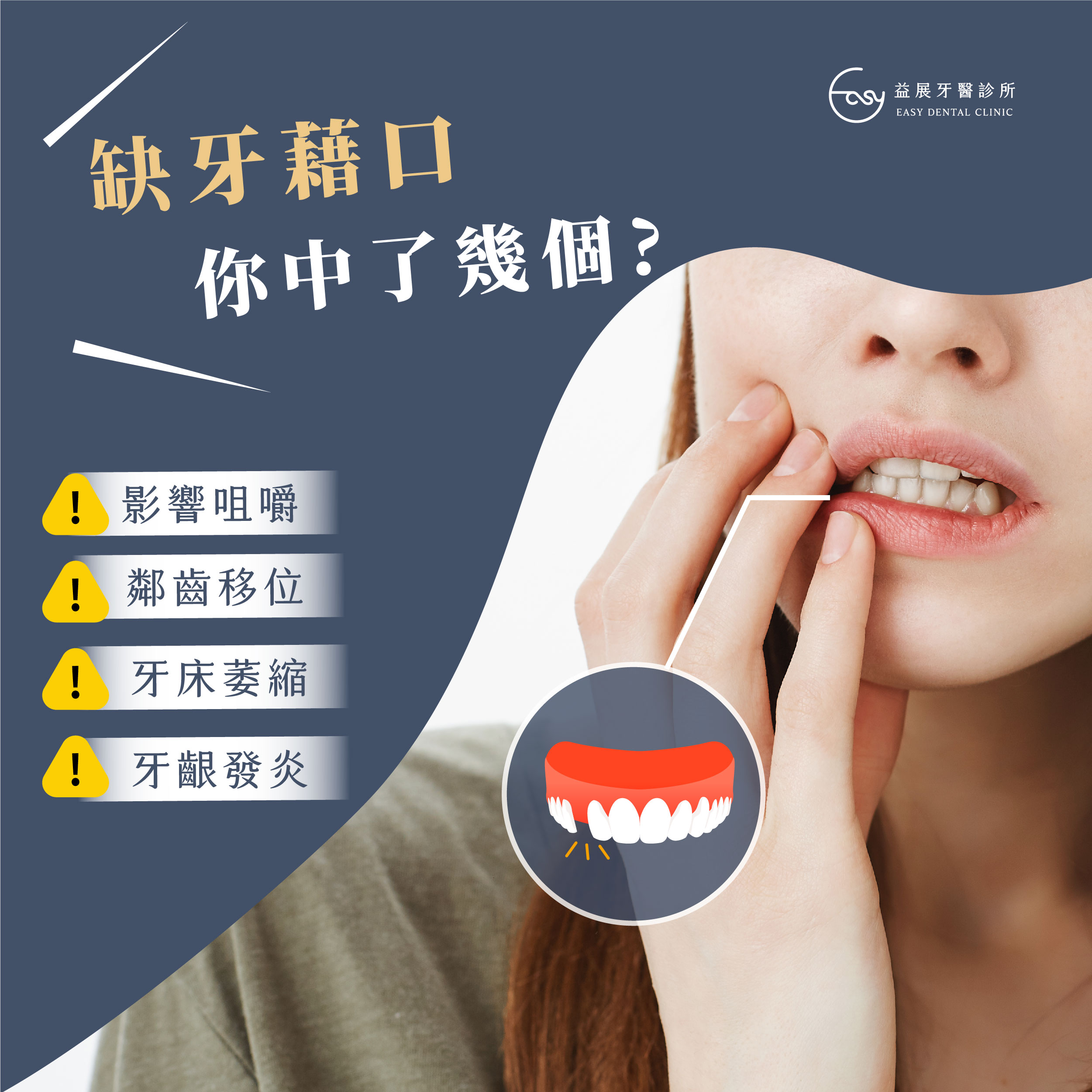 缺牙藉口你中了幾個?