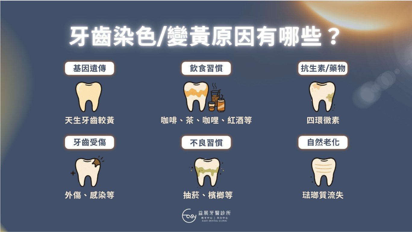 牙齒好黃?牙齒美白四大種類怎麼選?美白懶人包一次全介紹